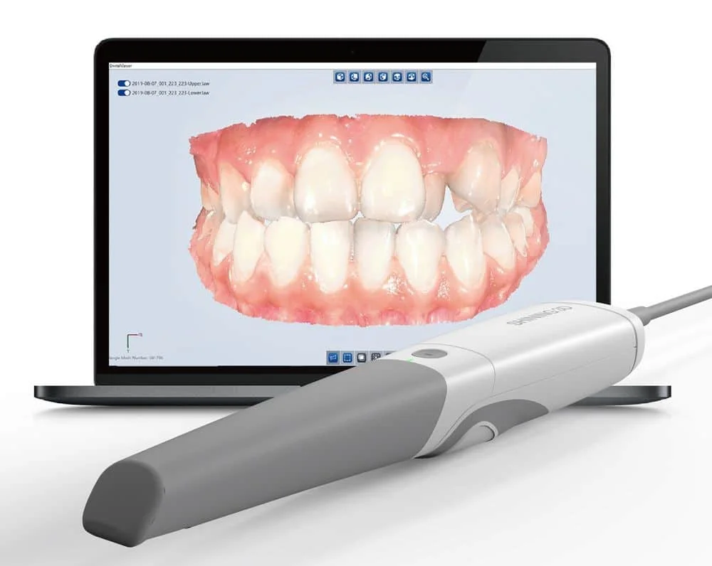 Intra-oral scanner wand mapping patient's teeth in 3D