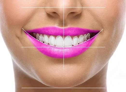 Smile Designing